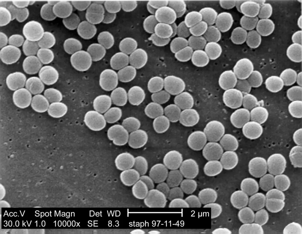 Imagen de estafilococos en un microscopio